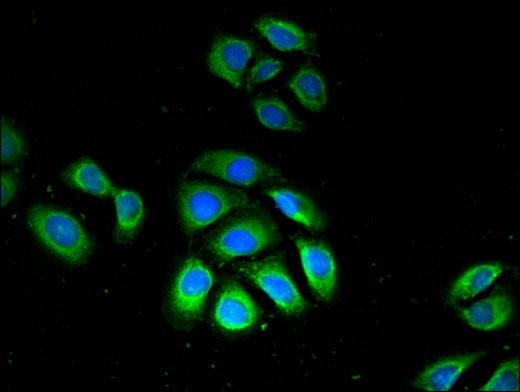 GPX4 / MCSP Antibody - Immunofluorescent analysis of A549 cells using GPX4 Antibody at a dilution of 1:100 and Alexa Fluor 488-congugated AffiniPure Goat Anti-Rabbit IgG(H+L)