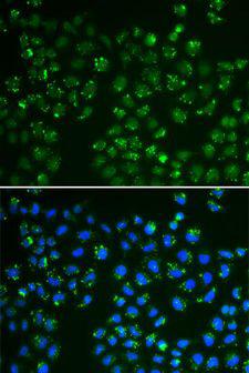 GPX4 / MCSP Antibody - Immunofluorescence analysis of A549 cells using GPX4 antibody. Blue: DAPI for nuclear staining.