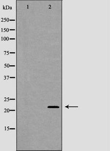 GPX4 / MCSP Antibody - Western blot analysis of HeLa cell lysates using GPX4 antibody. The lane on the left is treated with the antigen-specific peptide.
