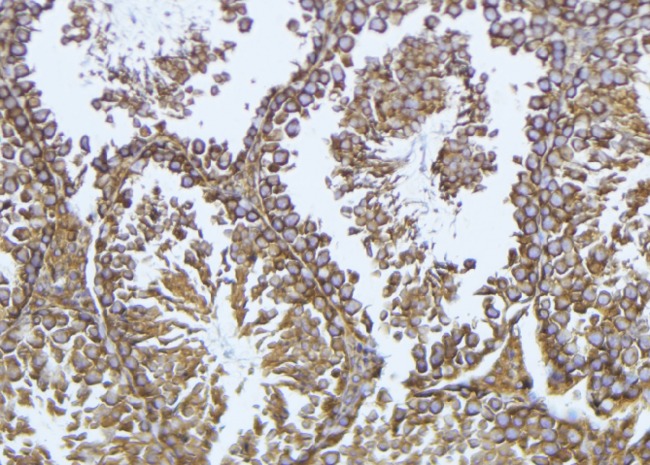 GPX4 / MCSP Antibody - 1:100 staining mouse testis tissue by IHC-P. The sample was formaldehyde fixed and a heat mediated antigen retrieval step in citrate buffer was performed. The sample was then blocked and incubated with the antibody for 1.5 hours at 22°C. An HRP conjugated goat anti-rabbit antibody was used as the secondary.
