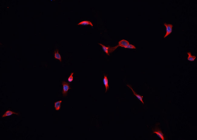 GPX4 / MCSP Antibody - Staining HepG2 cells by IF/ICC. The samples were fixed with PFA and permeabilized in 0.1% Triton X-100, then blocked in 10% serum for 45 min at 25°C. The primary antibody was diluted at 1:200 and incubated with the sample for 1 hour at 37°C. An Alexa Fluor 594 conjugated goat anti-rabbit IgG (H+L) antibody, diluted at 1/600, was used as secondary antibody.