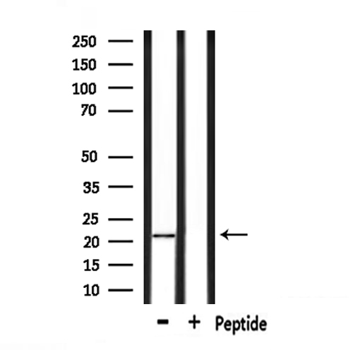 GPX4 / MCSP Antibody - Western blot analysis of extracts of 293 cells using GPX4 antibody.