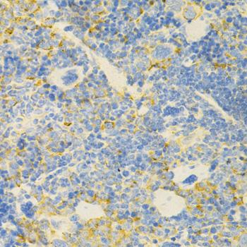 GPX4 / MCSP Antibody - Immunohistochemistry of paraffin-embedded Mouse spleen using GPX4 Polyclonal Antibody at dilution of 1:200 (40x lens).