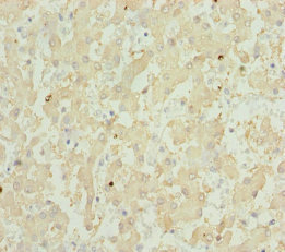 GPX5 Antibody - Immunohistochemistry of paraffin-embedded human liver tissue at dilution of 1:100