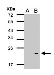 GPX7 Antibody - Western blot of GPX7 expression in transfected 293T cell line by GPX7 polyclonal antibody. A: Non-transfected lysate., B: GPX7 transfected lysate. 12% SDS PAGE. GPX7 antibody diluted at 1:500