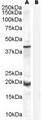 GPX7 Antibody - Antibody (0.3 ug/ml) staining of Human Prostate lysate (35 ug protein in RIPA buffer) with (B) and without (A) blocking with the immunizing peptide. Primary incubation was 1 hour. Detected by chemiluminescence.
