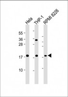 GPX7 Antibody - All lanes: Anti-GPX7 Antibody (Center) at 1:2000 dilution Lane 1: Hela whole cell lysate Lane 2: THP-1 whole cell lysate Lane 3: RPMI 8226 whole cell lysate Lysates/proteins at 20 µg per lane. Secondary Goat Anti-Rabbit IgG, (H+L), Peroxidase conjugated at 1/10000 dilution. Predicted band size: 21 kDa Blocking/Dilution buffer: 5% NFDM/TBST.