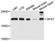GPX7 Antibody - Western blot analysis of extracts of Mouse liver tissue.