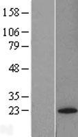 GPX7 Protein - Western validation with an anti-DDK antibody * L: Control HEK293 lysate R: Over-expression lysate