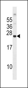 GPX8 Antibody - GPX8 Antibody western blot of 293 cell line lysates (35 ug/lane). The GPX8 antibody detected the GPX8 protein (arrow).