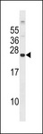 GPX8 Antibody - GPX8 Antibody western blot of 293 cell line lysates (35 ug/lane). The GPX8 antibody detected the GPX8 protein (arrow).