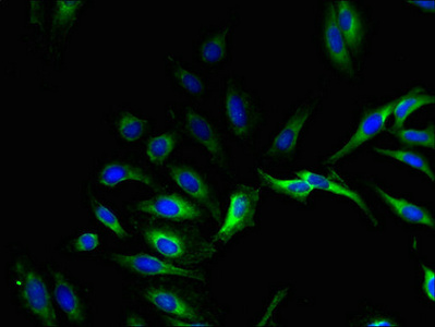 GPX8 Antibody - Immunofluorescent analysis of Hela cells using GPX8 Antibody at dilution of 1:100 and Alexa Fluor 488-congugated AffiniPure Goat Anti-Rabbit IgG(H+L)