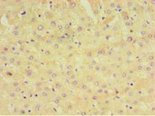 GRA1 / Dense granule protein 1 Antibody - Immunohistochemistry of paraffin-embedded human liver tissue using antibody at 1:100 dilution.  This image was taken for the unconjugated form of this product. Other forms have not been tested.
