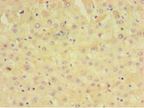 GRA1 / Dense granule protein 1 Antibody - Immunohistochemistry of paraffin-embedded human liver tissue using antibody at 1:100 dilution.  This image was taken for the unconjugated form of this product. Other forms have not been tested.