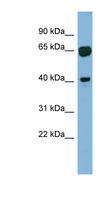 GRAB / RAB3IL1 Antibody - RAB3IL1 antibody Western blot of Fetal Muscle lysate. This image was taken for the unconjugated form of this product. Other forms have not been tested.
