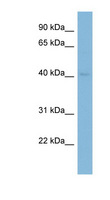 GRAB / RAB3IL1 Antibody - RAB3IL1 antibody Western blot of Fetal Lung lysate. This image was taken for the unconjugated form of this product. Other forms have not been tested.