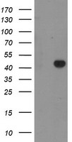 GRAB / RAB3IL1 Antibody - HEK293T cells were transfected with the pCMV6-ENTRY control (Left lane) or pCMV6-ENTRY RAB3IL1 (Right lane) cDNA for 48 hrs and lysed. Equivalent amounts of cell lysates (5 ug per lane) were separated by SDS-PAGE and immunoblotted with anti-RAB3IL1.