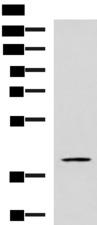GRAB / RAB3IL1 Antibody - Western blot analysis of TM4 cell lysate  using RAB3IL1 Polyclonal Antibody at dilution of 1:600