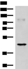 GRAB / RAB3IL1 Antibody - Western blot analysis of Human muscle tissue lysate  using RAB3IL1 Polyclonal Antibody at dilution of 1:1000