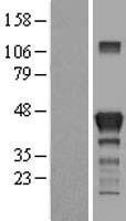 GRAB / RAB3IL1 Protein - Western validation with an anti-DDK antibody * L: Control HEK293 lysate R: Over-expression lysate