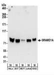GRAMD1A Antibody - Detection of Human GRAMD1A by Western Blot. Samples: Whole cell lysate (50 ug) from HeLa, 293T, MCF7, Jurkat, and K562 cells. Antibodies: Affinity purified rabbit anti-GRAMD1A antibody used for WB at 0.4 ug/ml. Detection: Chemiluminescence with an exposure time of 30 seconds.
