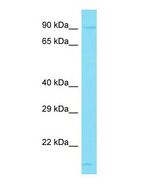 GRAMD1B Antibody - Western blot of GRAMD1B Antibody - N-terminal region with human Jurkat cells lysate.  This image was taken for the unconjugated form of this product. Other forms have not been tested.