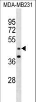 GRAMD3 Antibody - GRAMD3 Antibody (N-term )western blot of MDA-MB231 cell line lysates (35 ug/lane). The GRAMD3 antibody detected the GRAMD3 protein (arrow).