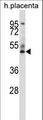 GRAMD3 Antibody - GRAMD3 Antibody (N-term ) western blot of human placenta tissue lysates (35 ug/lane). The GRAMD3 antibody detected the GRAMD3 protein (arrow).