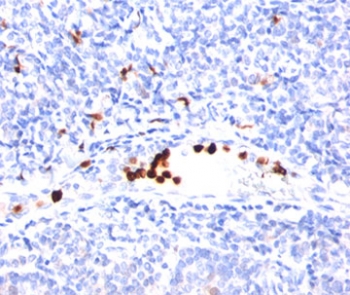 Granulocyte Antibody - Granulocyte Marker antibody BM-2 immunohistochemistry tonsil.  This image was taken for the unmodified form of this product. Other forms have not been tested.