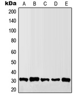 Granzyme B+H Antibody - Western blot analysis of Granzyme B/H expression in MCF7 (A); Raw264.7 (B); SP2/0 (C); H9C2 (D); HL60 (E) whole cell lysates.