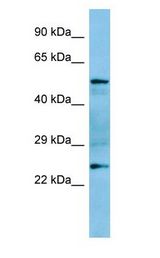 GRAP Antibody - GRAP antibody Western Blot of Rat Spleen.  This image was taken for the unconjugated form of this product. Other forms have not been tested.
