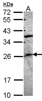 GRAP Antibody - Sample (30 ug of whole cell lysate). A: A549 12% SDS PAGE. GRAP antibody diluted at 1:1000.