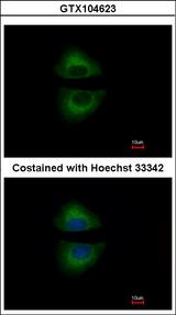 GRAP Antibody - Immunofluorescence of methanol-fixed A549 using GRAP antibody at 1:500 dilution.