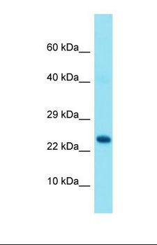 GRAP Antibody - Western blot of Human Fetal Brain. GRAP antibody dilution 1.0 ug/ml.  This image was taken for the unconjugated form of this product. Other forms have not been tested.