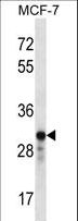 GRAP2 / GRID Antibody - GRAP2 Antibody western blot of MCF-7 cell line lysates (35 ug/lane). The GRAP2 antibody detected the GRAP2 protein (arrow).
