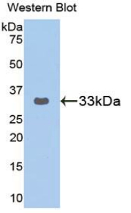 GRAP2 / GRID Antibody - Western blot of recombinant GRAP2 / GRID.  This image was taken for the unconjugated form of this product. Other forms have not been tested.
