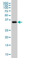 GRAP2 / GRID Antibody - GRAP2 monoclonal antibody (M01), clone 1G12 Western blot of GRAP2 expression in Jurkat.