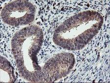 GRAP2 / GRID Antibody - IHC of paraffin-embedded Human endometrium tissue using anti-GRAP2 mouse monoclonal antibody.