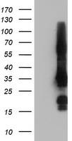 GRAP2 / GRID Antibody - HEK293T cells were transfected with the pCMV6-ENTRY control (Left lane) or pCMV6-ENTRY GRAP2 (Right lane) cDNA for 48 hrs and lysed. Equivalent amounts of cell lysates (5 ug per lane) were separated by SDS-PAGE and immunoblotted with anti-GRAP2.