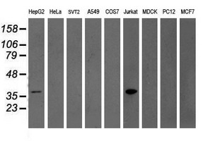GRAP2 / GRID Antibody - Western blot of extracts (35 ug) from 9 different cell lines by using anti-GRAP2 monoclonal antibody.