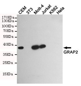 GRAP2 / GRID Antibody - Western blot detection of GRAP2 in GRAP2 positive cell (CEM, Molt-4, Jurkat) and negative cell (3T3, K562, HeLa) lysates using GRAP2 mouse monoclonal antibody (1:1000 dilution). Predicted band size: 38KDa. Observed band size:38KDa.
