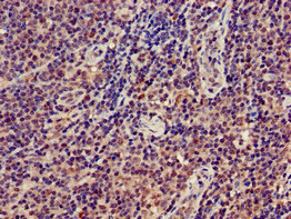 GRAP2 / GRID Antibody - Immunohistochemistry of paraffin-embedded human lymph node tissue at dilution of 1:100