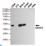 GRAP2 / GRID Antibody - Western blot detection of GRAP2 in GRAP2 positive cell (CEM, Molt-4, Jurkat) and negative cell (3T3, K562, Hela) lysates using GRAP2 mouse mAb (1:1000 diluted). Predicted band size: 38KDa. Observed band size: 38KDa.