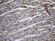 Gravin / AKAP12 Antibody - Immunohistochemical staining of paraffin-embedded Human adult heart tissue within the normal limits using anti-AKAP12 mouse monoclonal antibody. (Heat-induced epitope retrieval by 1mM EDTA in 10mM Tris buffer. (pH8.5) at 120 oC for 3 min. (1:500)