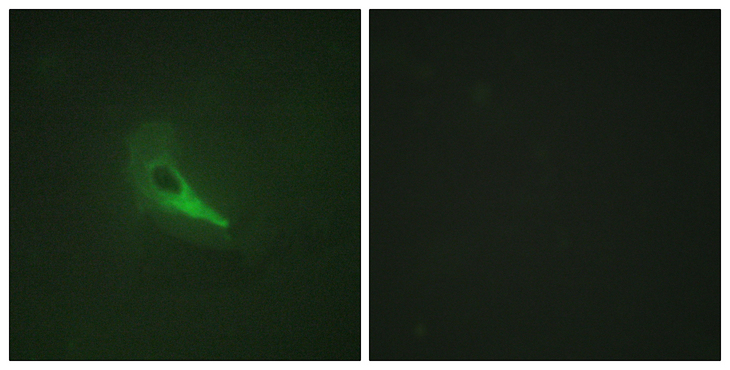 Gravin / AKAP12 Antibody - Immunofluorescence analysis of HeLa cells, using AKAP12 Antibody. The picture on the right is blocked with the synthesized peptide.