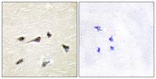 Gravin / AKAP12 Antibody - Immunohistochemistry analysis of paraffin-embedded human brain tissue, using AKAP12 Antibody. The picture on the right is blocked with the synthesized peptide.