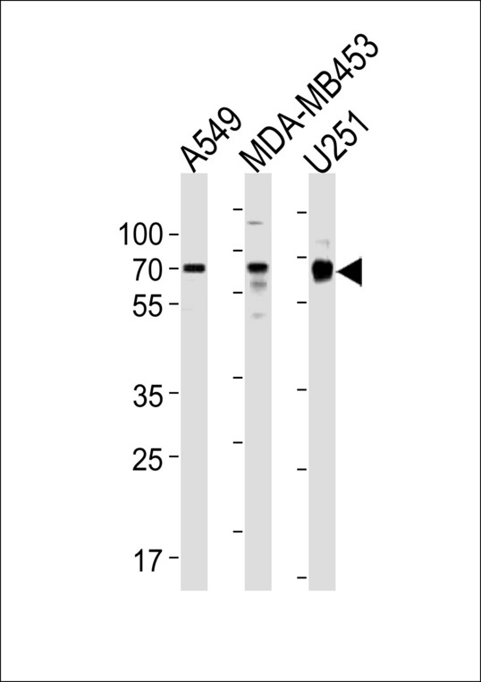 GRB10 Antibody - GRB10 Antibody western blot of A549,MDA-MB453,U251 cell line lysates (35 ug/lane). The GRB10 antibody detected the GRB10 protein (arrow).