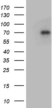 GRB10 Antibody - HEK293T cells were transfected with the pCMV6-ENTRY control. (Left lane) or pCMV6-ENTRY GRB10. (Right lane) cDNA for 48 hrs and lysed