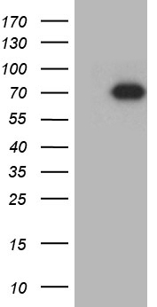 GRB10 Antibody - HEK293T cells were transfected with the pCMV6-ENTRY control. (Left lane) or pCMV6-ENTRY GRB10. (Right lane) cDNA for 48 hrs and lysed