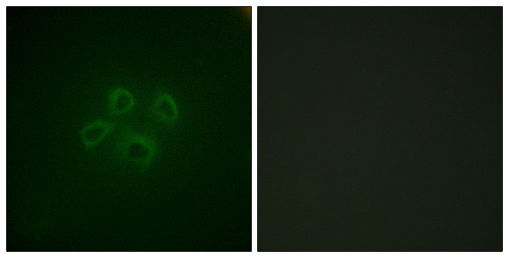GRB10 Antibody - Immunofluorescence analysis of HepG2 cells, using GRB10 Antibody. The picture on the right is blocked with the synthesized peptide.